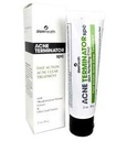 Adama Minerals Acne Terminator SPC Zion Health 2 oz Liquid 2