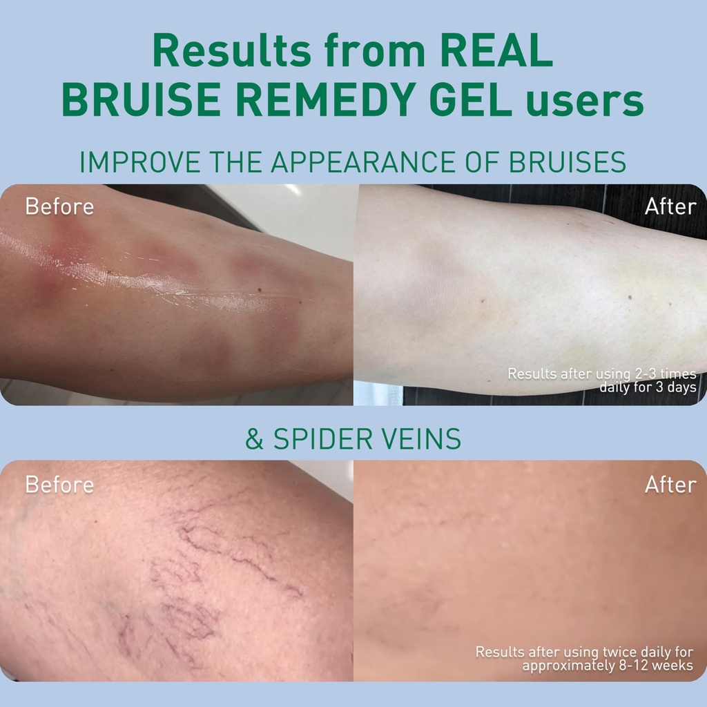 procure-arnica-msm-bruise-remedy-gel-par-5.jpg