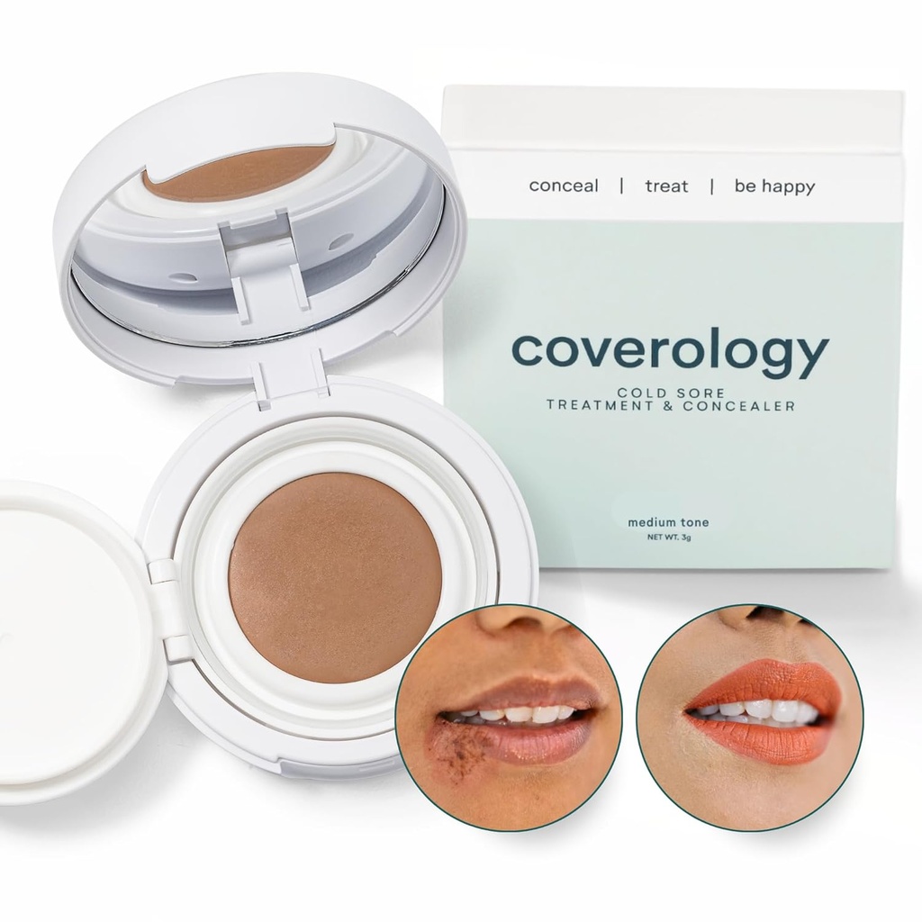 Coverology Cold Sore Treatment & Cold Sore Concealer - The Best Full Coverage Cold Sore Cover Up Makeup to Help Disguise and Soothe - Medium