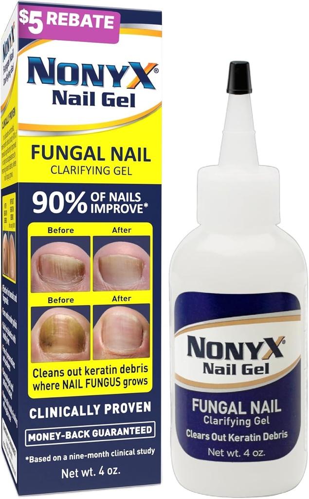 NONYX Fungal Nail Clarifying Gel | Clinically Proven for Discolored, Thick, Brittle, Yellow, Lifted, and other signs of Fungus-Damaged Toenails | 90% of Nails Improve | Over 8 million sold