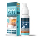 Scar Gel, Scar Cream, Advance Scar Gel for Surgical Scars for Surgical Scars, C-Section, Stretch Marks, Acne, Injury, Burns, Keloids, Old and New Scars,1.7oz